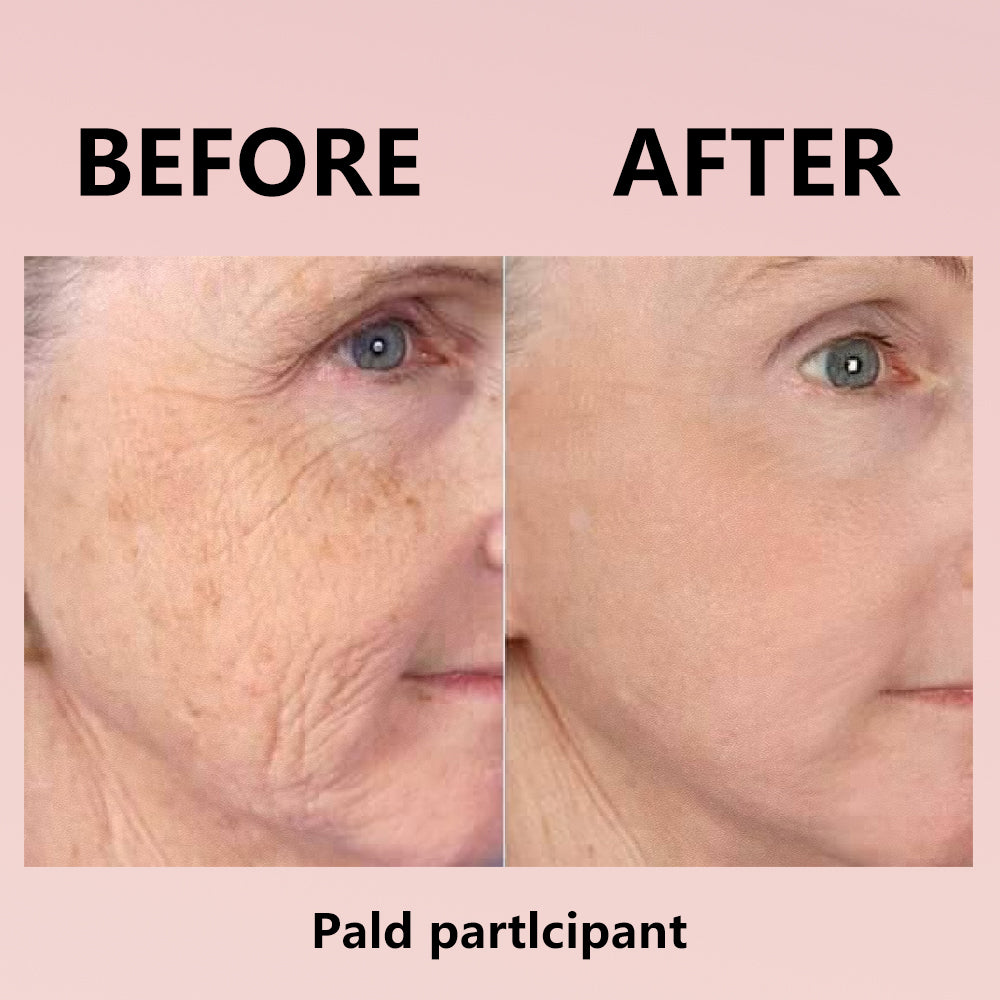 🔥 Hydrolyzed Collagen Night Mask for Glowing Skin-Erase Wrirkles✨𝐋𝐚𝐬𝐭 𝐃𝐚𝐲 𝐃𝐢𝐬𝐜𝐨𝐮𝐧𝐭: 87% 𝐎𝐅𝐅