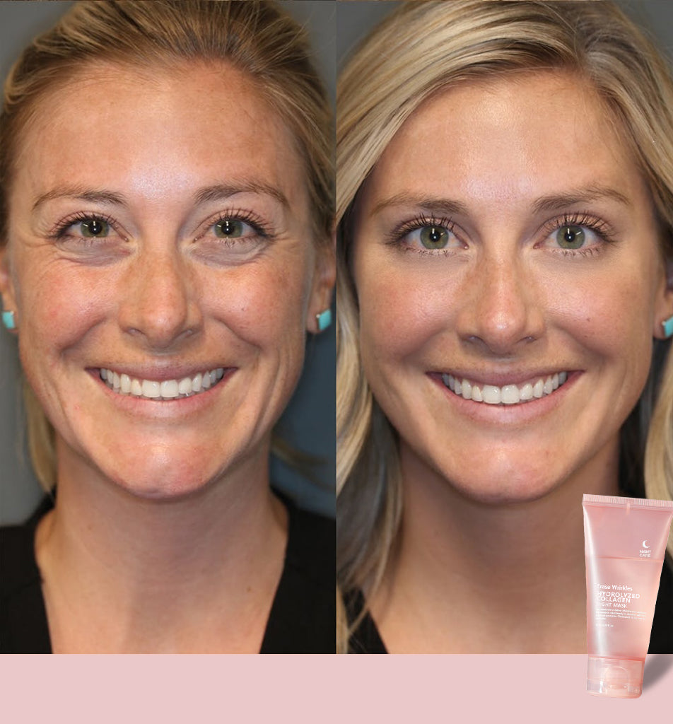 🔥 Hydrolyzed Collagen Night Mask for Glowing Skin-Erase Wrirkles✨𝐋𝐚𝐬𝐭 𝐃𝐚𝐲 𝐃𝐢𝐬𝐜𝐨𝐮𝐧𝐭: 87% 𝐎𝐅𝐅