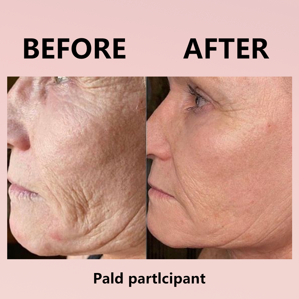 🔥 Hydrolyzed Collagen Night Mask for Glowing Skin-Erase Wrirkles✨𝐋𝐚𝐬𝐭 𝐃𝐚𝐲 𝐃𝐢𝐬𝐜𝐨𝐮𝐧𝐭: 87% 𝐎𝐅𝐅