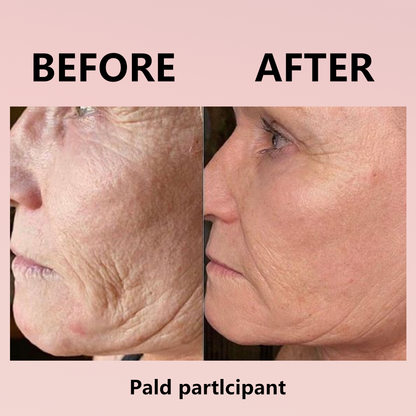 🔥 Hydrolyzed Collagen Night Mask for Glowing Skin-Erase Wrirkles✨𝐋𝐚𝐬𝐭 𝐃𝐚𝐲 𝐃𝐢𝐬𝐜𝐨𝐮𝐧𝐭: 87% 𝐎𝐅𝐅