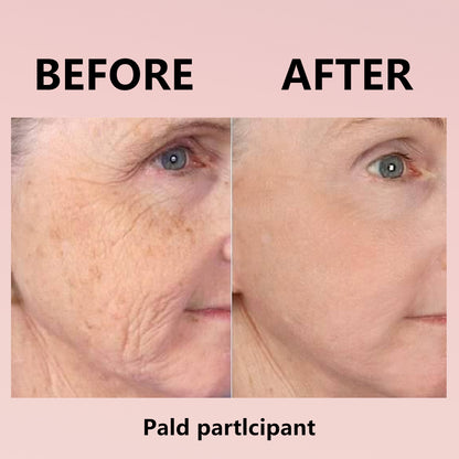 🔥 Hydrolyzed Collagen Night Mask for Glowing Skin-Erase Wrirkles✨𝐋𝐚𝐬𝐭 𝐃𝐚𝐲 𝐃𝐢𝐬𝐜𝐨𝐮𝐧𝐭: 87% 𝐎𝐅𝐅