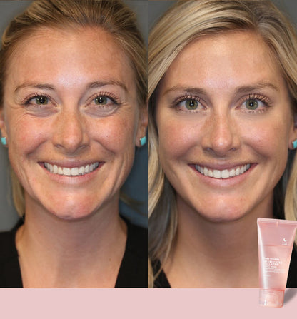 🔥 Hydrolyzed Collagen Night Mask for Glowing Skin-Erase Wrirkles✨𝐋𝐚𝐬𝐭 𝐃𝐚𝐲 𝐃𝐢𝐬𝐜𝐨𝐮𝐧𝐭: 87% 𝐎𝐅𝐅